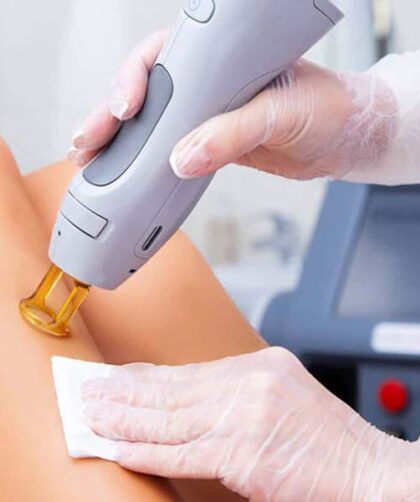 brooklyn laser hair removal as