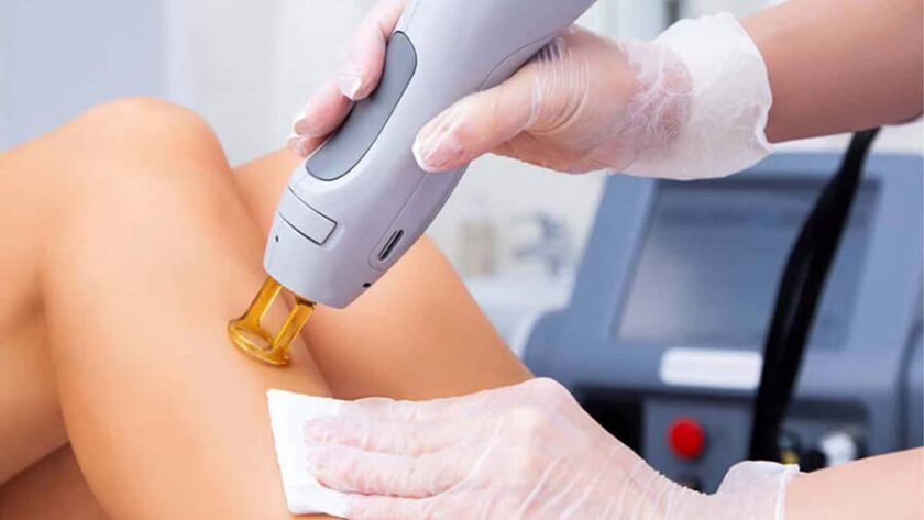 brooklyn laser hair removal as