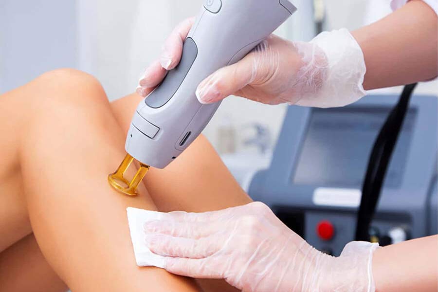 brooklyn laser hair removal as